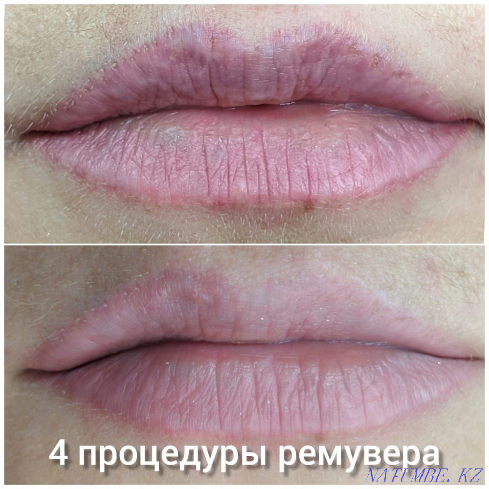 Татуировка қасы ерін көрсеткілері мен татуировканы алып тастау. Жоюшы, лазер  Астана - изображение 5