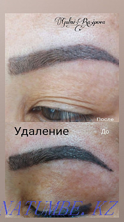 Permanent makeup. Revivingcom Removal Qaskeleng - photo 1