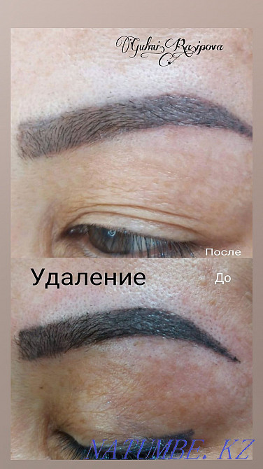 Permanent makeup. Revivingcom Removal Qaskeleng - photo 1