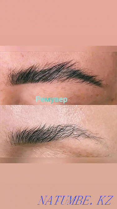 Удаление ремувером некачественного татуажа Алматы - изображение 4