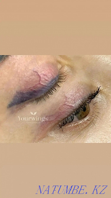 Удаление ремувером некачественного татуажа Алматы - изображение 2