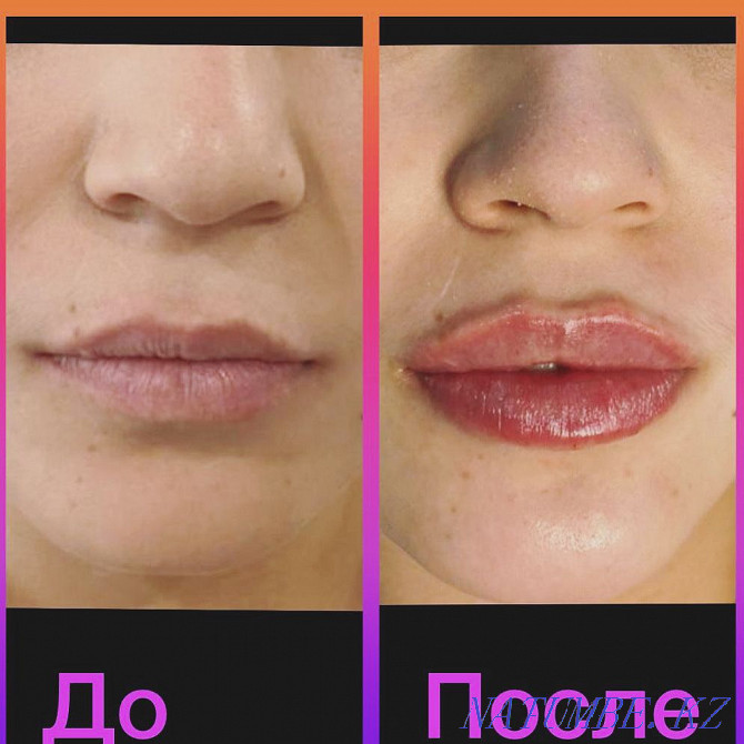 Cosmetic services! Stock !!! Almaty - photo 6