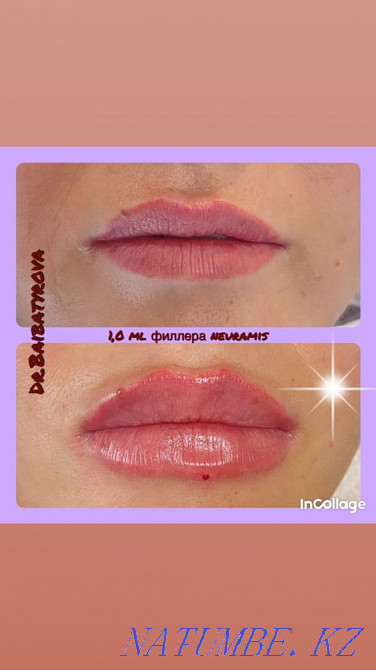 Косметологические услуги ! Акция !!! Алматы - изображение 2