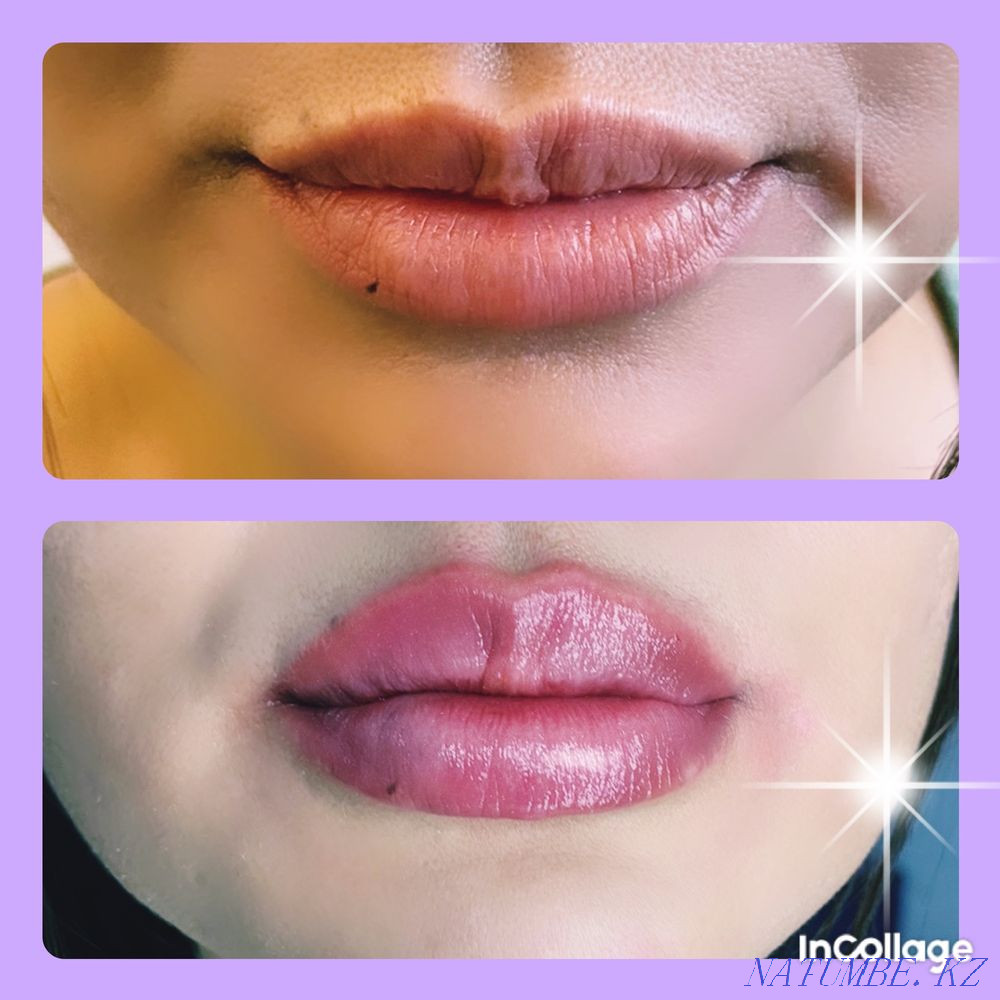 Косметологические услуги ! Акция !!! Алматы - изображение 3