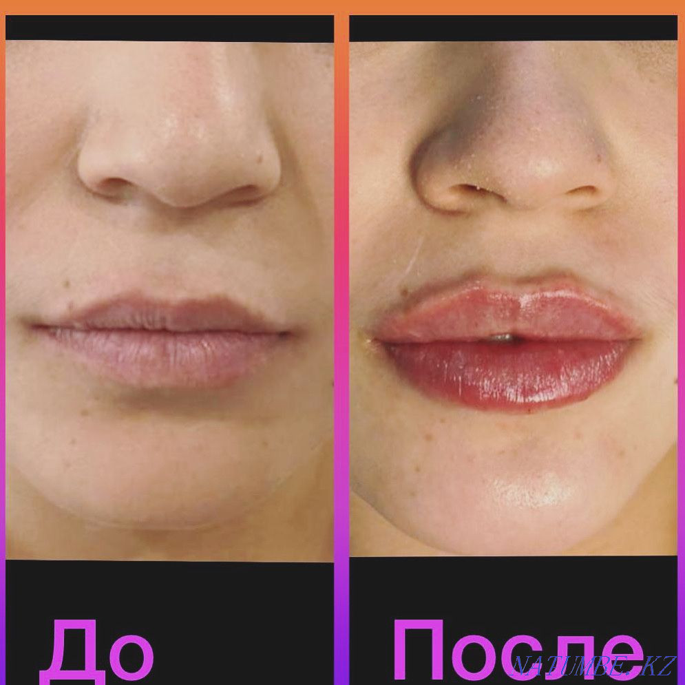 Косметологические услуги ! Акция !!! Алматы - изображение 6