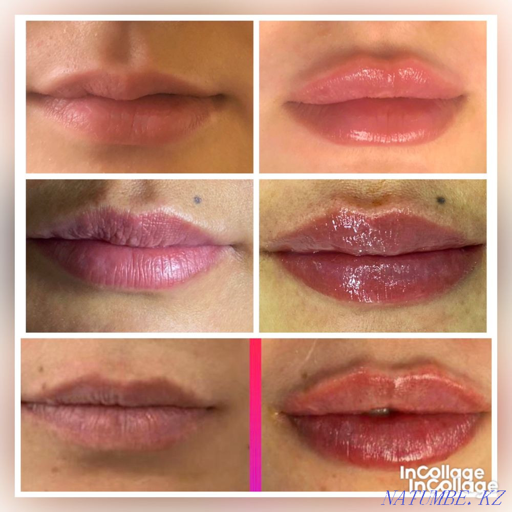 Косметологические услуги ! Акция !!! Алматы - изображение 5