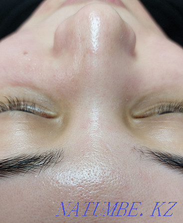 Promotion!!! Facial cleansing 8000 instead of 15000 Almaty - photo 3