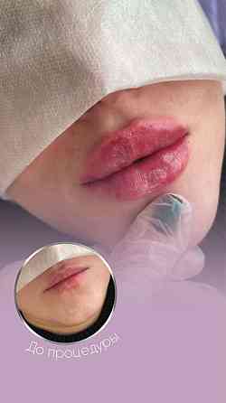 Уаеличение губ, ботокс, гипергидроз , чистка лица Almaty