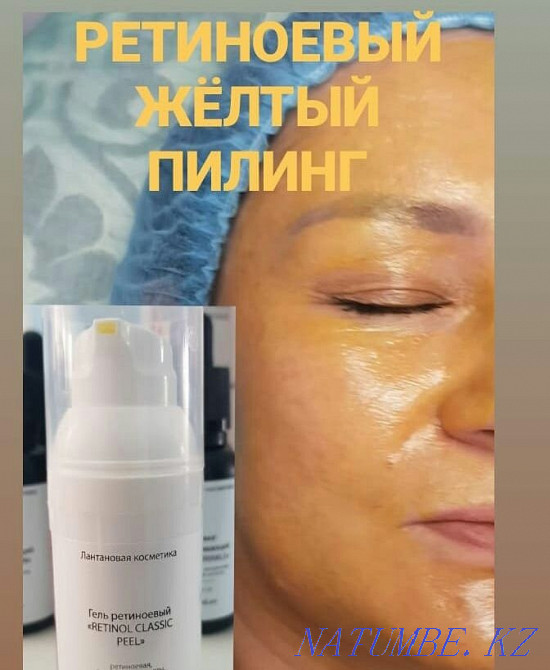 Плазмалифт удаление морщин Алматы - изображение 5