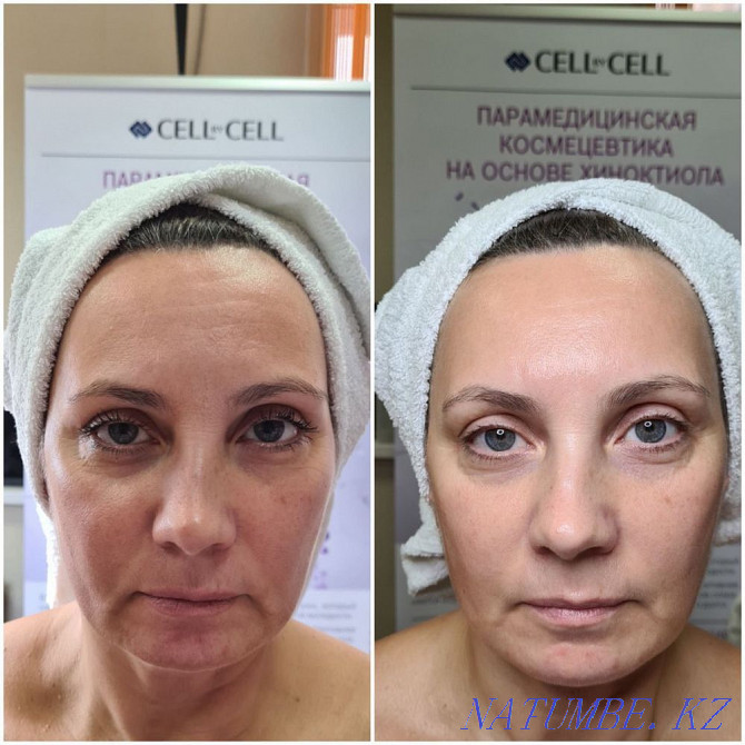 Cosmetology. Facial care Astana - photo 6