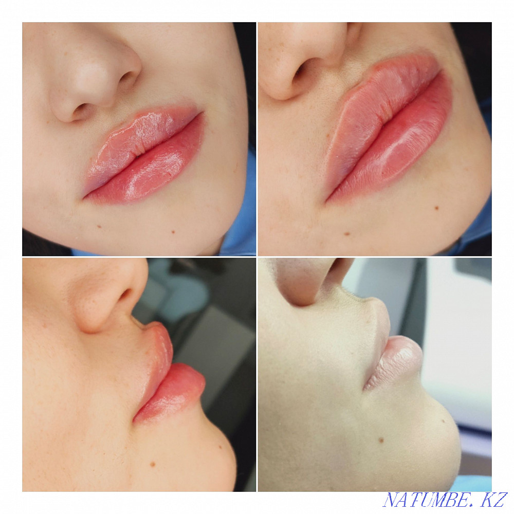 Косметолог с медицинским образованием Кокшетау - изображение 2