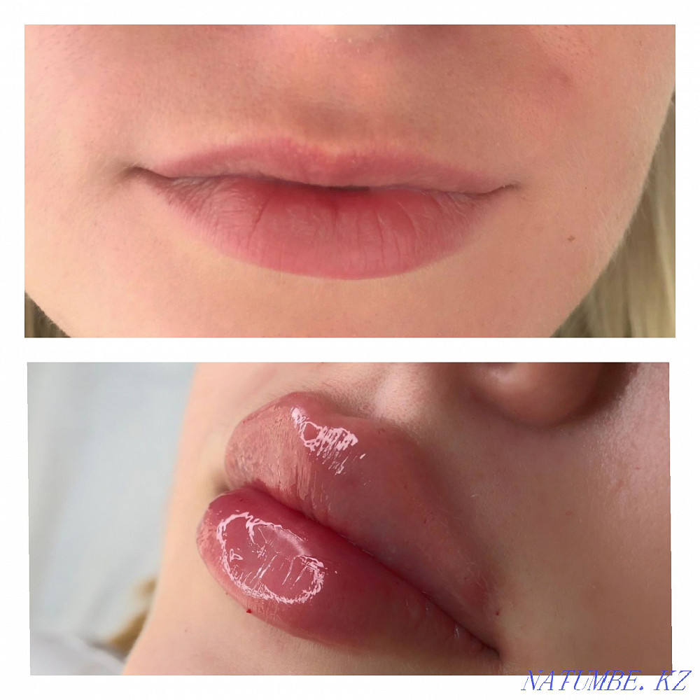 Косметолог с медицинским образованием Кокшетау - изображение 3