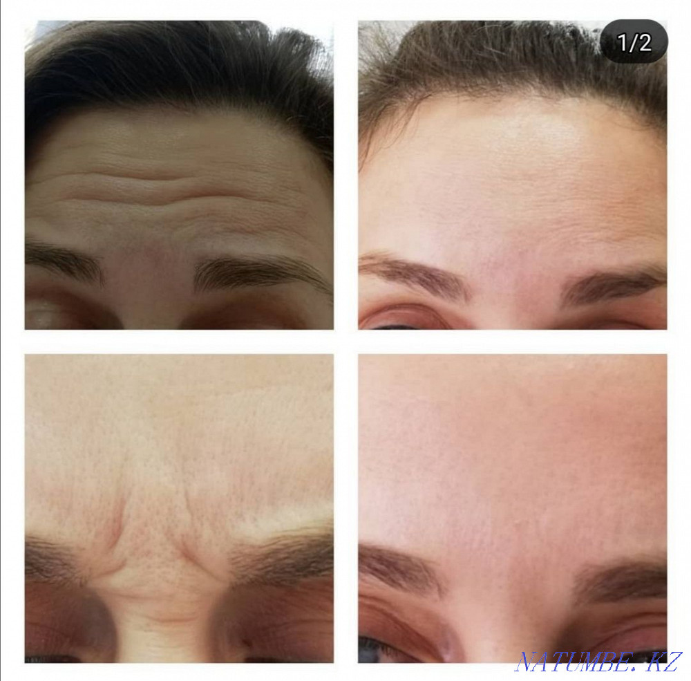 Косметолог с медицинским образованием Кокшетау - изображение 7