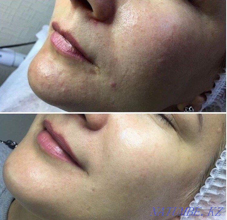 BB Glow биби эффект тоналки на год Каскелен - изображение 8