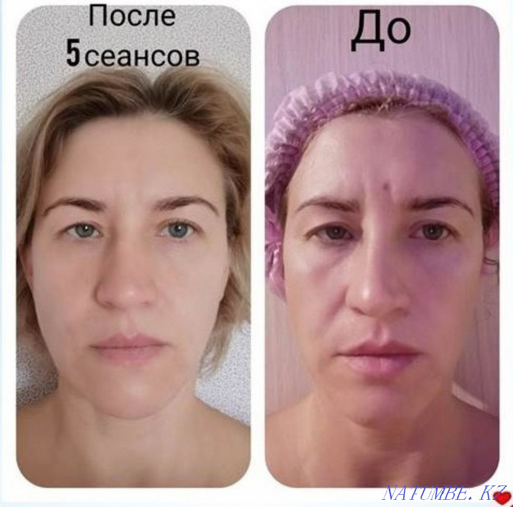 Массаж лица от FOHOW (БиоЭнергоЛифтинг) Атырау - изображение 2