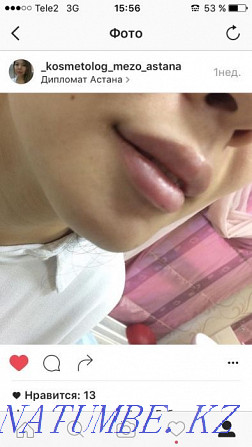 Promotion!!! Lip augmentation - from 26 thousand and above Astana - photo 4