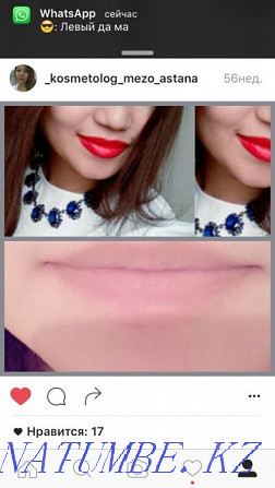 Promotion!!! Lip augmentation - from 26 thousand and above Astana - photo 2
