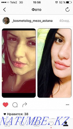 Promotion!!! Lip augmentation - from 26 thousand and above Astana - photo 3