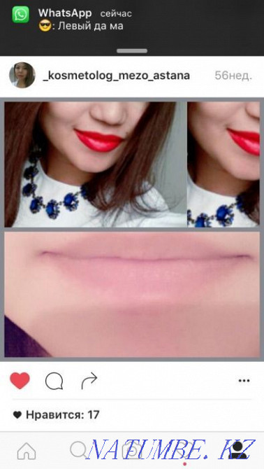 Акция!!!Увеличение губ -от26тыс и выше Астана - изображение 2