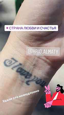 Лазерное удаление татуировки, татуажа со скидкой Almaty