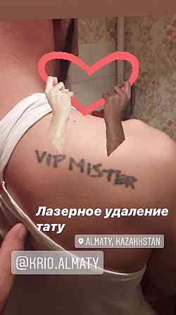 Лазерное удаление татуировки, татуажа со скидкой  Алматы