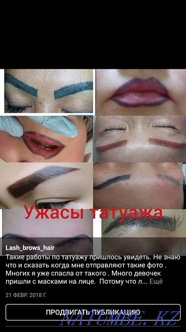 Лазерное удаление татуировки, татуажа со скидкой Алматы - изображение 6