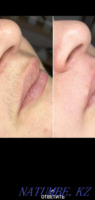 Комплексная чистка лица, массаж, калоген гель, маска Талгар - изображение 4