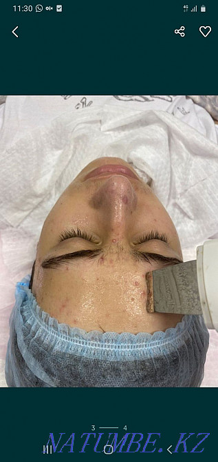 Комплексная чистка лица, массаж, калоген гель, маска Талгар - изображение 6