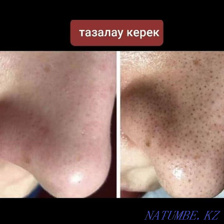 Комплексная чистка лица, массаж, калоген гель, маска Талгар - изображение 3