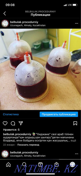 Treatment/Cosmetology/Hijama  - photo 5