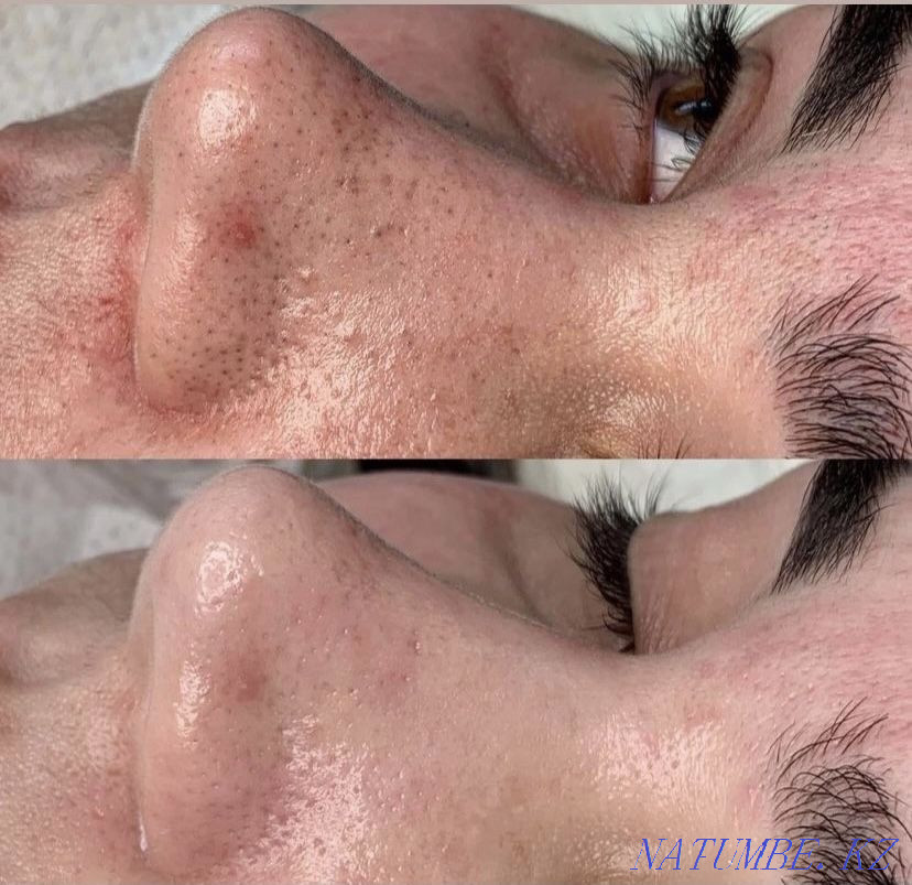 Treatment/Cosmetology/Hijama  - photo 2