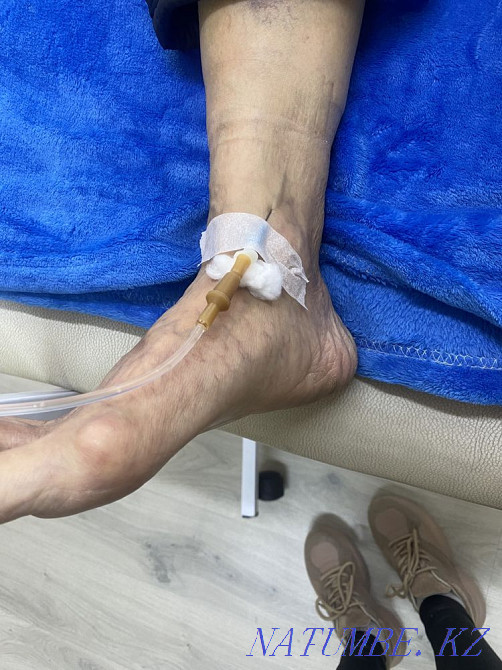 Treatment/Cosmetology/Hijama  - photo 8