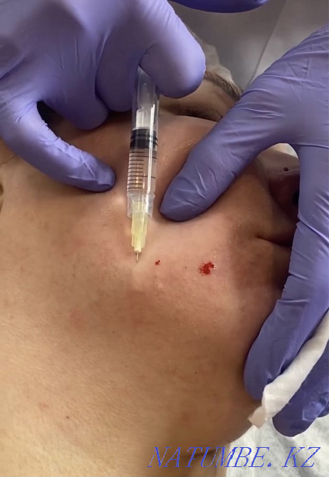 Treatment/Cosmetology/Hijama  - photo 3