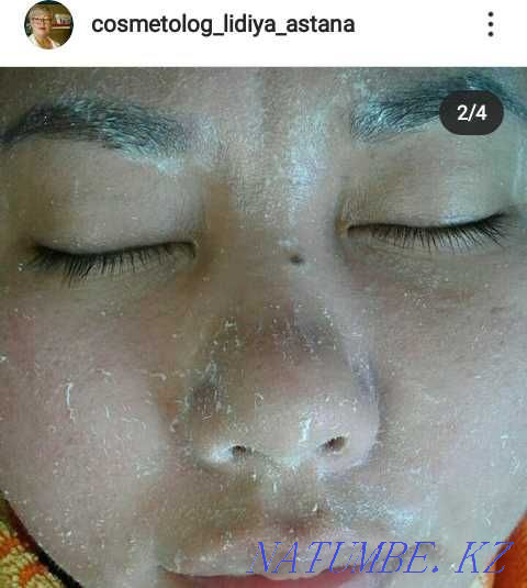 Facial cleansing from 3000 Astana - photo 6