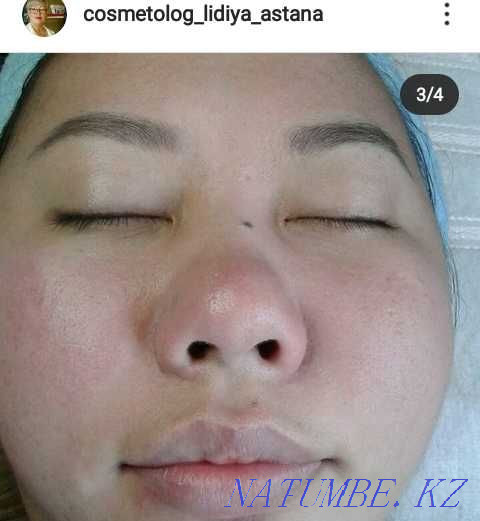 Facial cleansing from 3000 Astana - photo 7