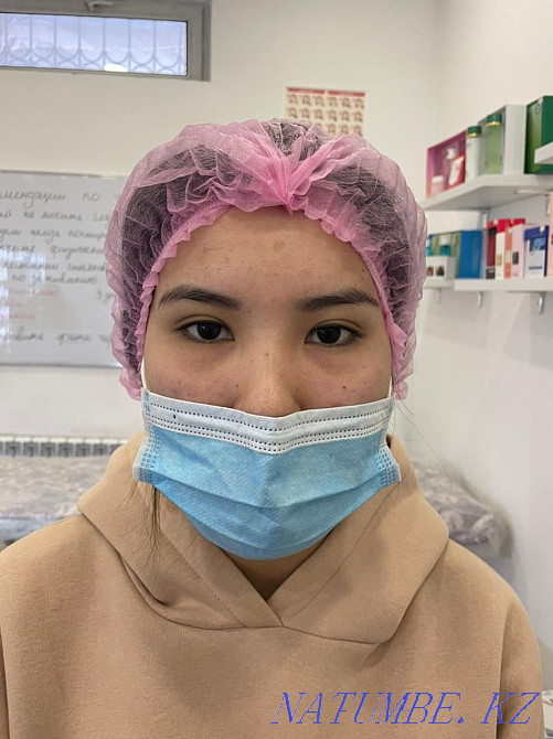 Нитевая блеферопластика  - изображение 3