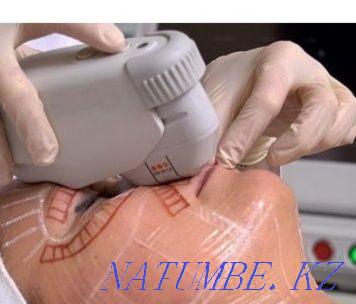 Hardware cosmetology Ust-Kamenogorsk - photo 3