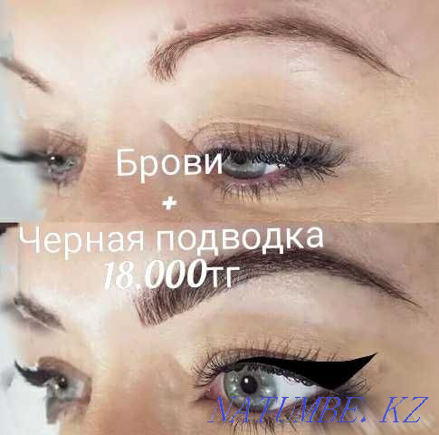 Tattoo, Cleaning, Blepharoplasty, BbGlow, Mole RemovalPapilloma Stretch Marks Shymkent - photo 1