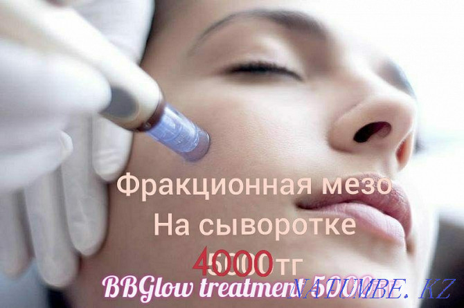 Tattoo, Cleaning, Blepharoplasty, BbGlow, Mole RemovalPapilloma Stretch Marks Shymkent - photo 5