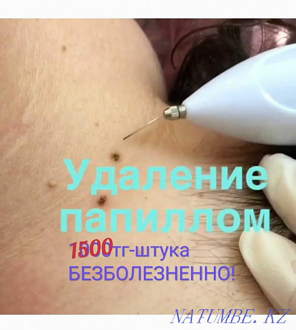 Татуаж,Чистка,Блефаропластика,BbGlow,УдалениеРодинокПапилломРастяжек Шымкент - изображение 6