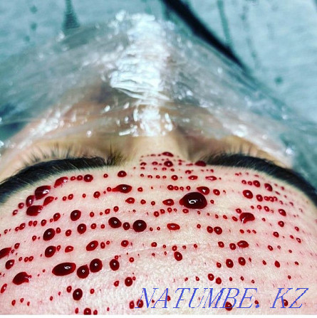 CT, facial capillary therapy, facial massage, Call or write Almaty - photo 1