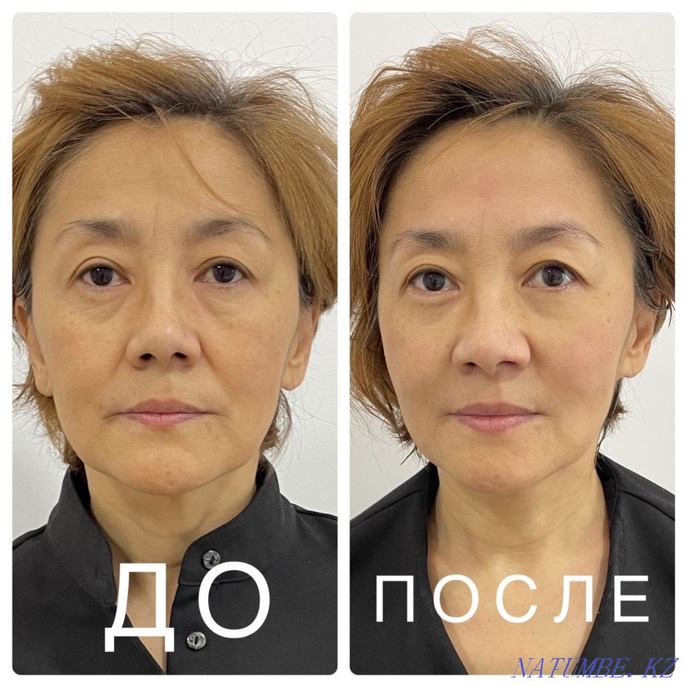 Promotion for Smas lifting 50% Almaty - photo 2