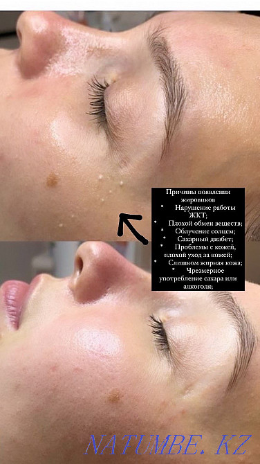 Косметолог Чистка лица Караганда - изображение 7