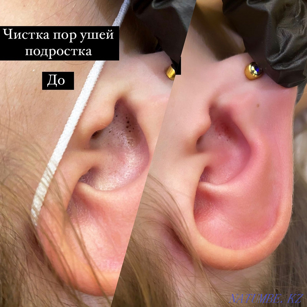 Косметолог Чистка лица Караганда - изображение 5