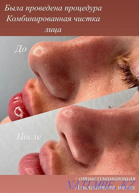 Косметолог Чистка лица Караганда - изображение 6