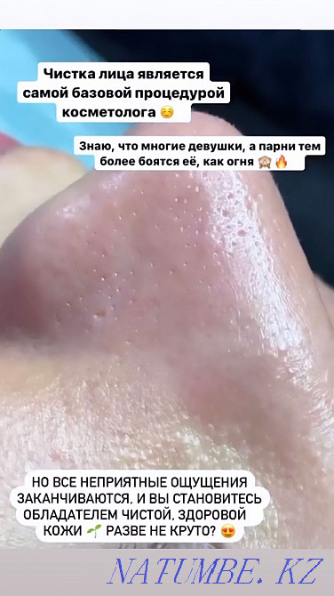 Косметолог Чистка лица Караганда - изображение 8