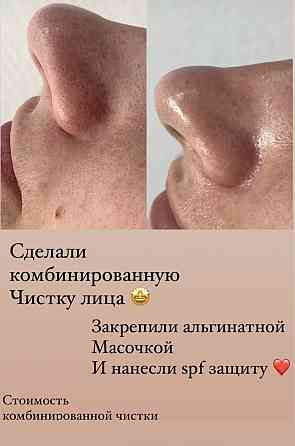 Чистка лица косметология Karagandy