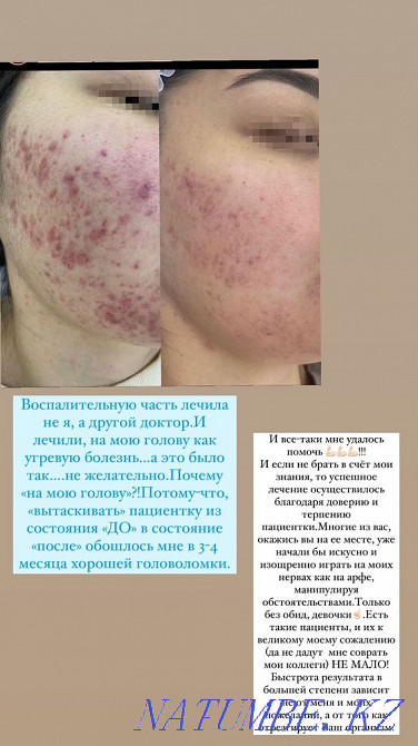 Чистка лица косметология Караганда - изображение 6