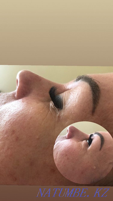 Чистка Комбинированная Пилинги Массажи лица ! Караганда - изображение 2