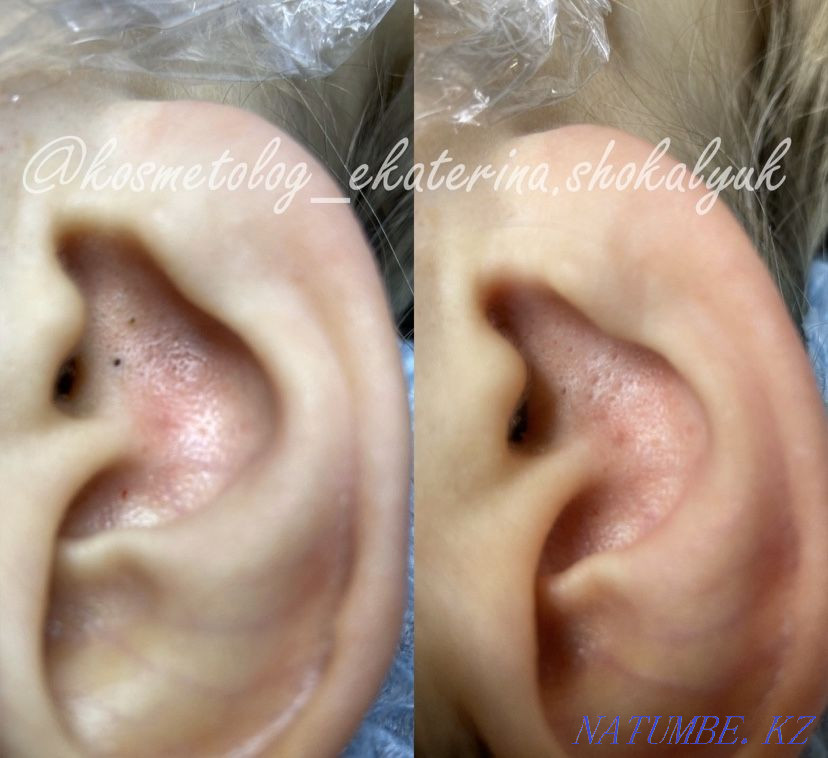 Facial cleansing cosmetologist Karagandy - photo 6